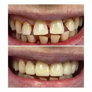 Jeannie A. Molato,DMD -Laser Dental Bakersfield