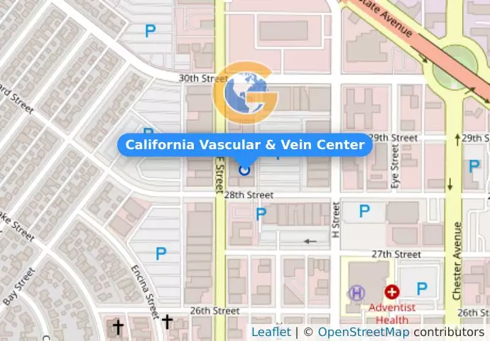 California Vascular & Vein Center