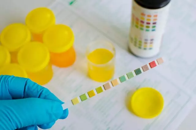Bakersfield Drugtesting