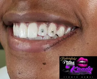 Bakersfield Tooth Kandy